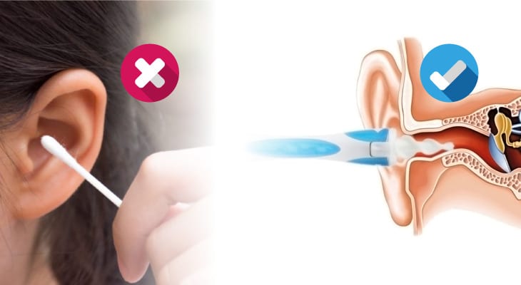Wie funktioniert ein guter Ohrenreiniger
