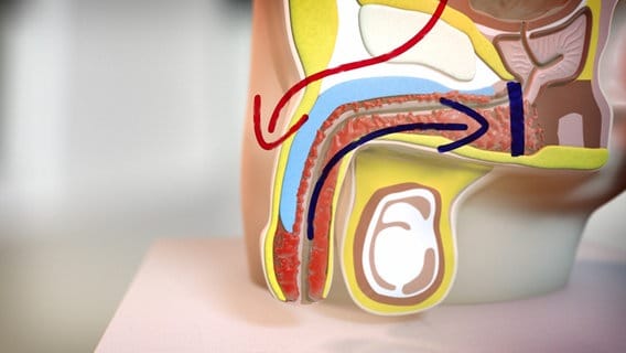 Sildenafil Nebenwirkungen