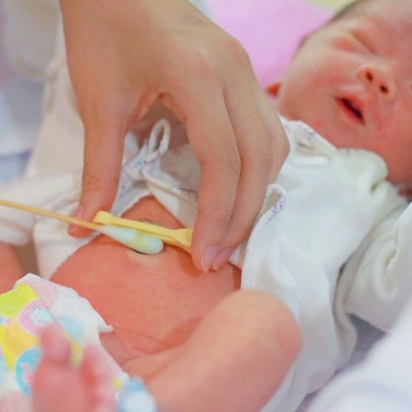 List 94+ Pictures Newborn Diapers With A Cut Out Space For The Cord Sharp