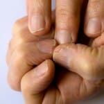 Bad finger nails