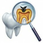 Internal structure of tooth