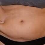 Woman having fat belly