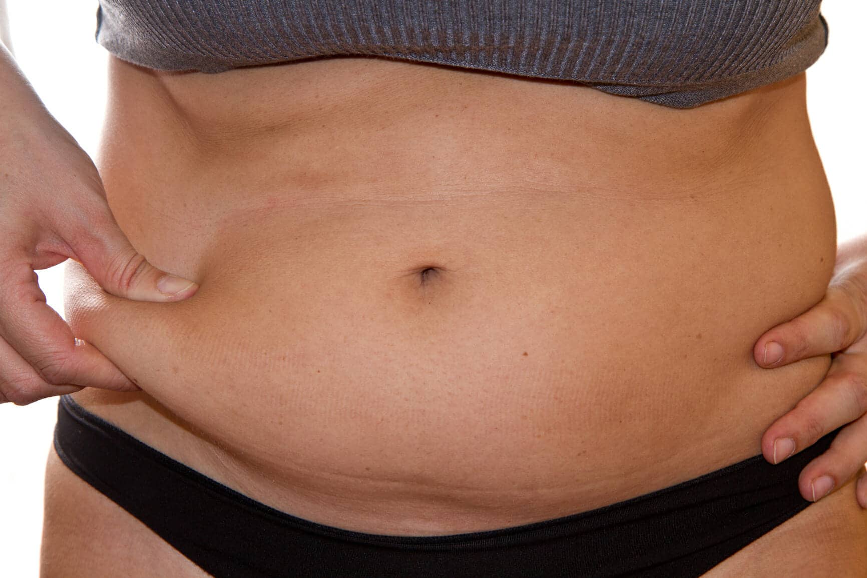 Woman having fat belly