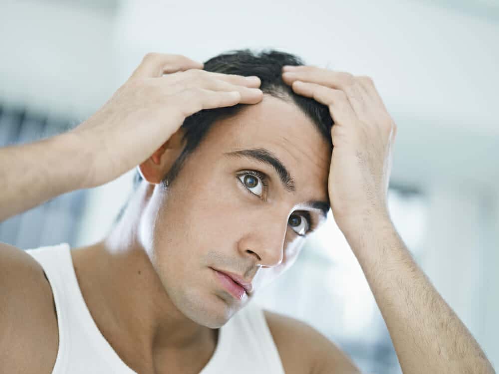 man-needs-hair-transplant-alternatives