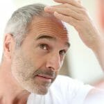 man-thinking-about-hair-transplant
