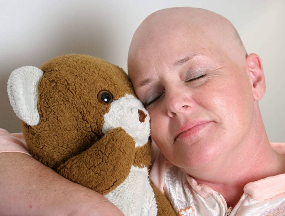 Chemotherapy Hair Loss - The American Hair Loss Council