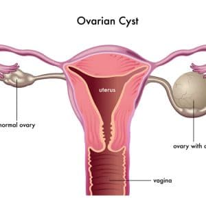 Symptoms of increased testosterone