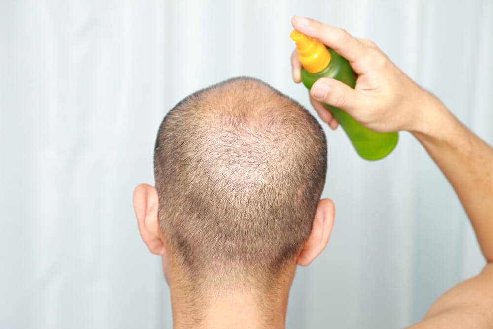 Natural Hair Products to Counter Hair Loss - HealthStatus