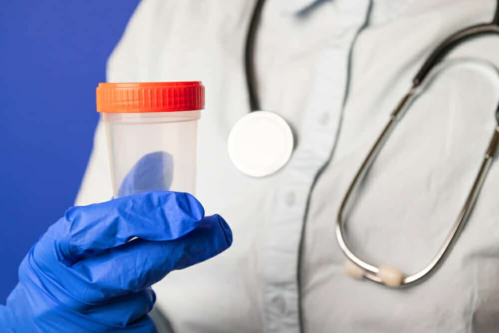 Pathological test pitcher. Medical concept of testing cancer cells. Doctor in latex gloves holding empty plastic container for taking urine