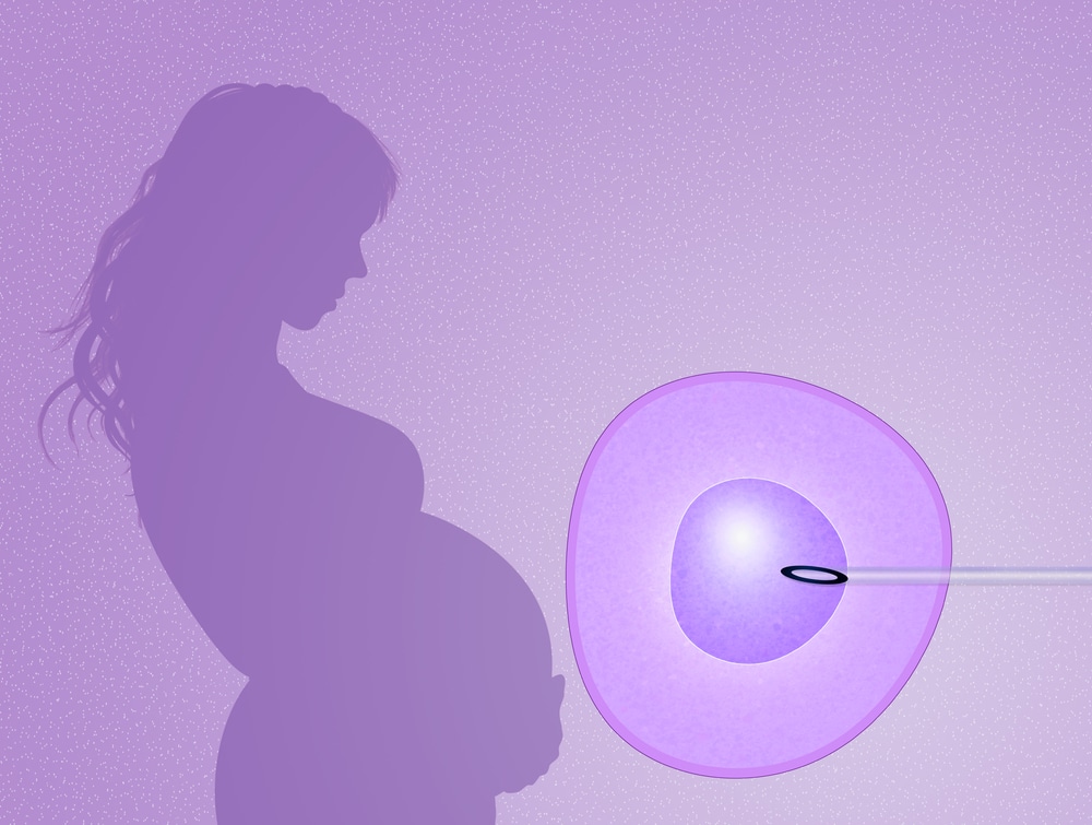 assisted reproduction