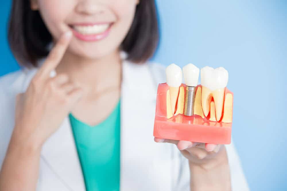 How Are Dental Implants Made? HealthStatus