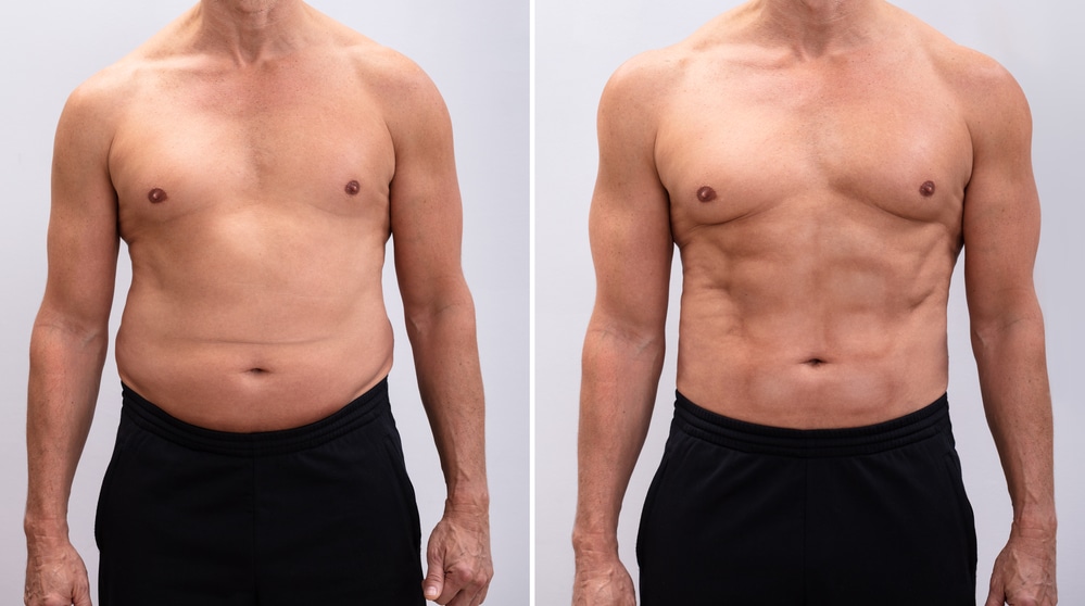 Mature Man Before And After Weight Loss On White Background