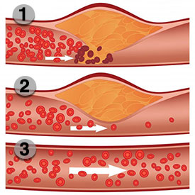 Blood-Flow-Optimizer-Ingredients