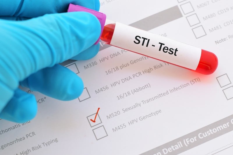 How quickly does an STD Test Kit work