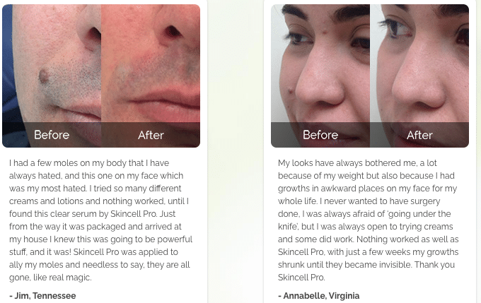 Skincell Pro Before After