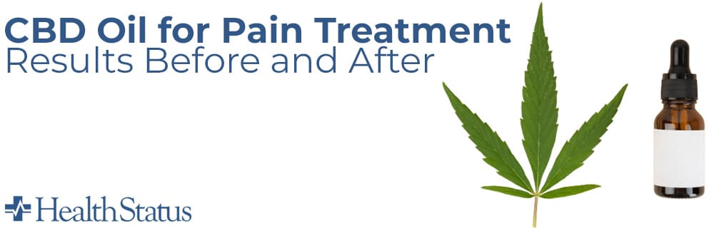 CBD Oil for Pain Results
