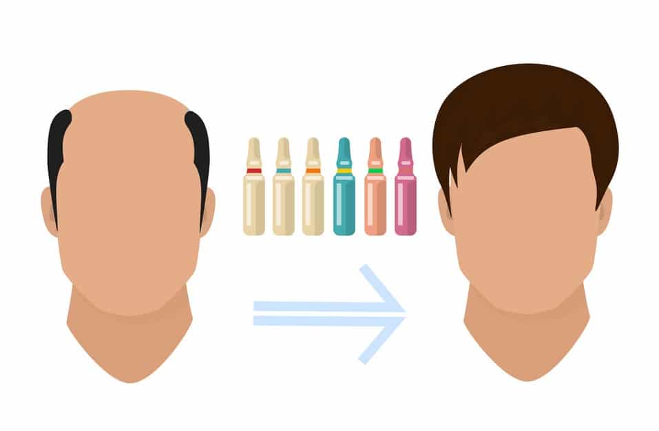 Best Hair Loss Treatment Healthstatus 2024