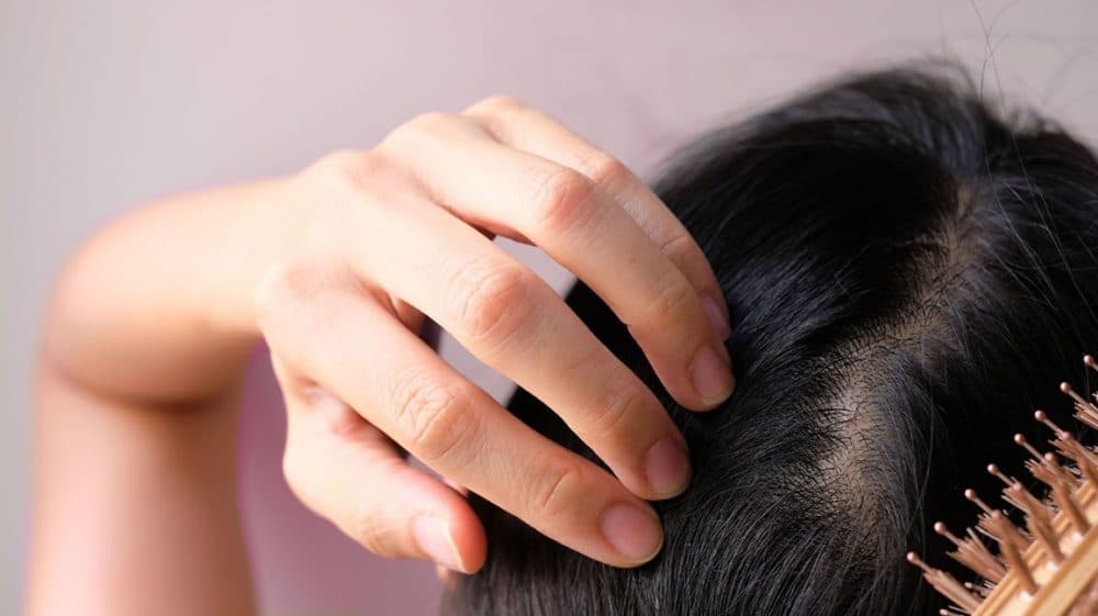 Effect of hair loss treatment