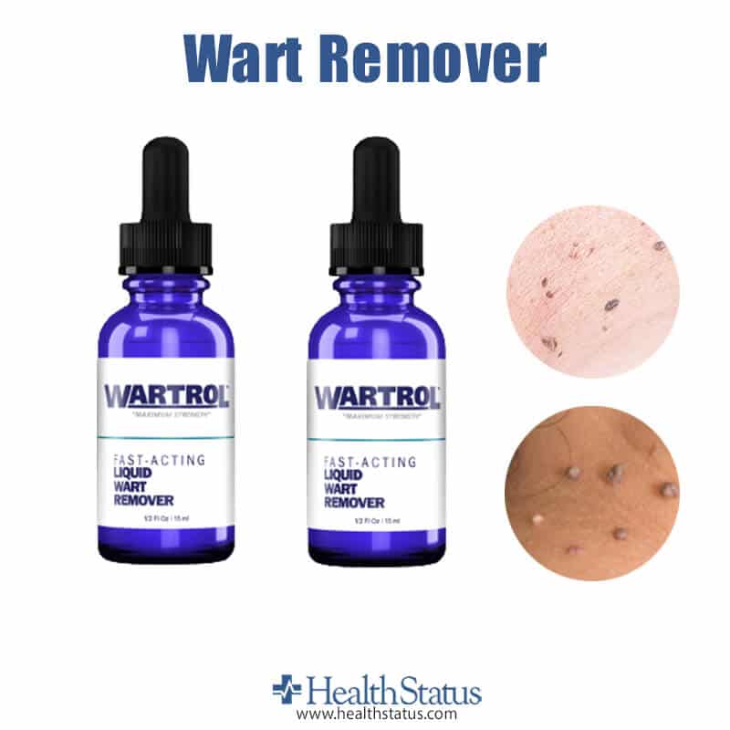 What is Wart Remover?