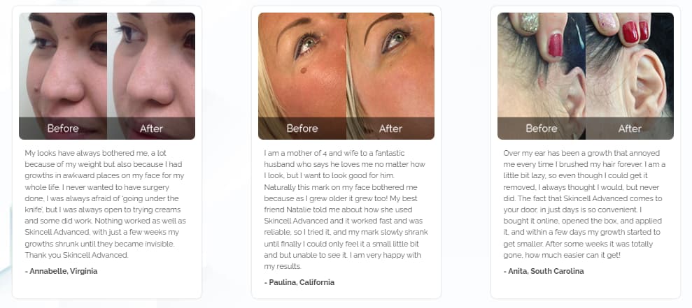 Skincell Pro Before After