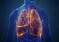 Mesothelioma