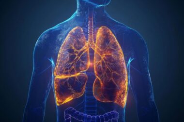 Mesothelioma